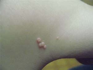 ÝOKANÇLY  MOLLÝUSK