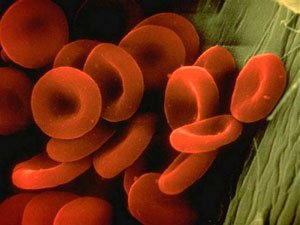 DEMIR  ÝETMEZÇILIKLI  GANAZLYLYK