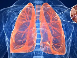 ÖÝKEN EMFIZEMASY: SEBÄPLERI, ALAMATLARY WE BEJERGISI