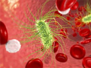 SEPSIS: SEBÄPLERI, ALAMATLARY WE GAÝRAÜZÜLMELERI