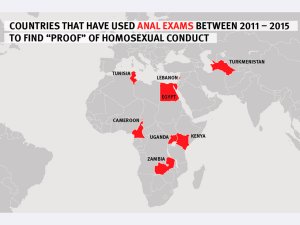 ADAM MERTEBESINIŇ KEMSIDILMEGI: MEJBURY ANAL BARLAGLAR